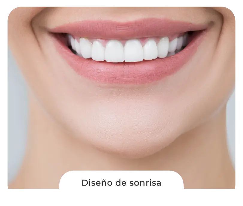 diseno sonrisa